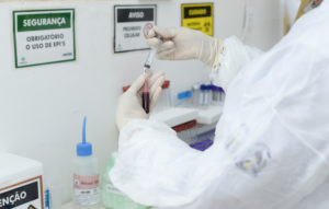 Laboratório de Palmas recebe 2.500 testes rápidos e expande exames para detecção de coronavírus